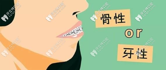 判斷你是牙性齙牙還是骨性 判斷你是牙性齙牙還是骨性