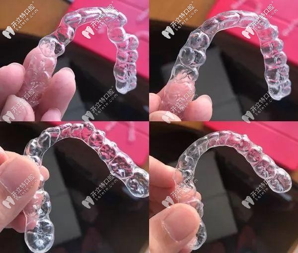 隱形牙套的外觀實(shí)拍圖 隱形牙套的外觀實(shí)拍圖