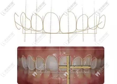 牙博士口腔牙齒矯正美學(xué)標(biāo)準(zhǔn) 牙博士口腔牙齒矯正美學(xué)標(biāo)準(zhǔn)