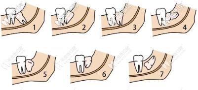 銅川惠美佳口腔價格表一覽,洗牙補牙費用也就是一頓飯錢