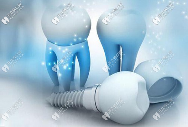 種植牙選純鈦和鈦合金材料有啥區(qū)別，做核磁共振有影響嗎