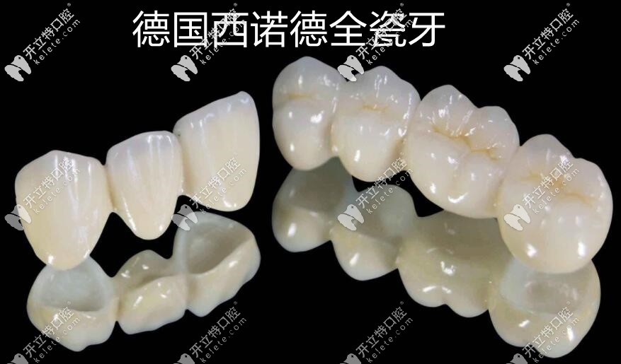 德國西諾德全瓷牙品牌