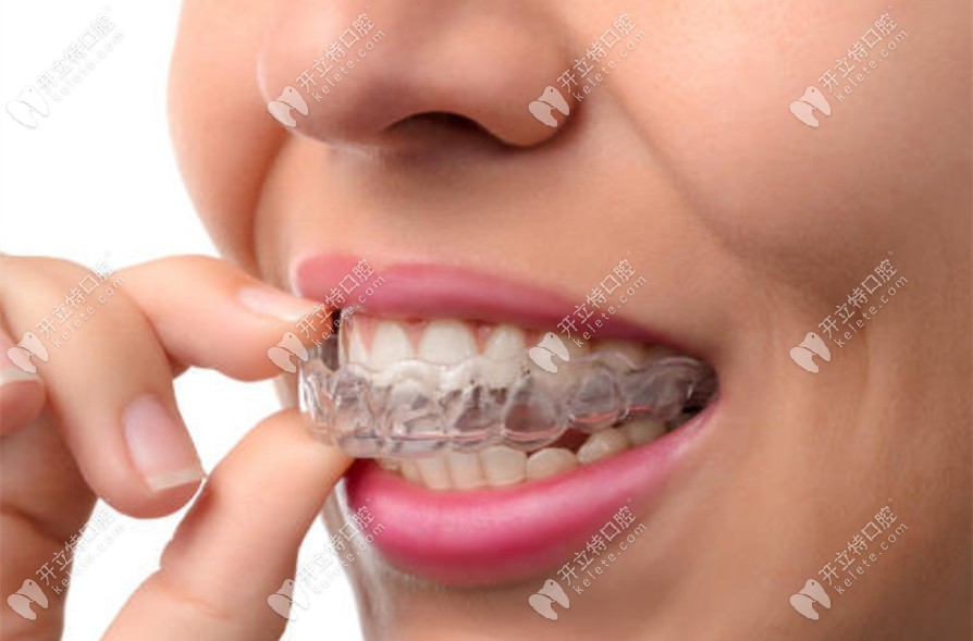 都江堰華藝口腔隱形矯正 都江堰華藝口腔隱形矯正
