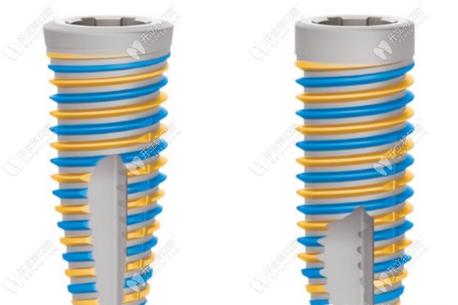 瑞典尼斯奧種植體