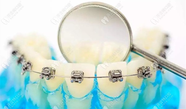 趙曉輝院長(zhǎng)淺談?wù)e(cuò)誤加力的弊端 趙曉輝院長(zhǎng)淺談?wù)e(cuò)誤加力的弊端