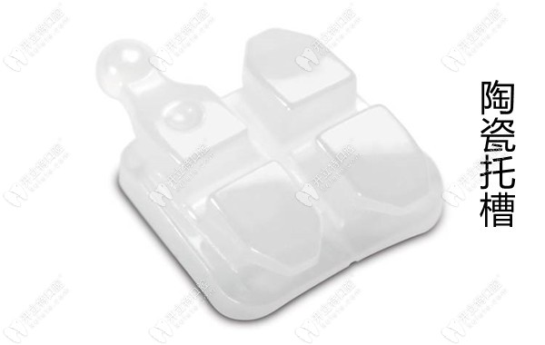 骨性錯頜選擇奧美科Symetri陶瓷托槽矯正時考慮的五個因素