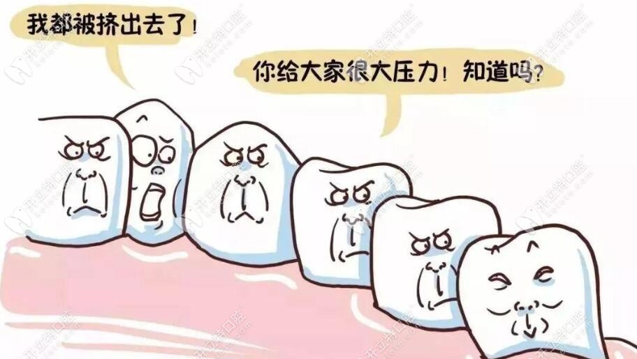 需要拔智齒的圖片嗎？它長什么樣哎？別再讓它傷害你了！