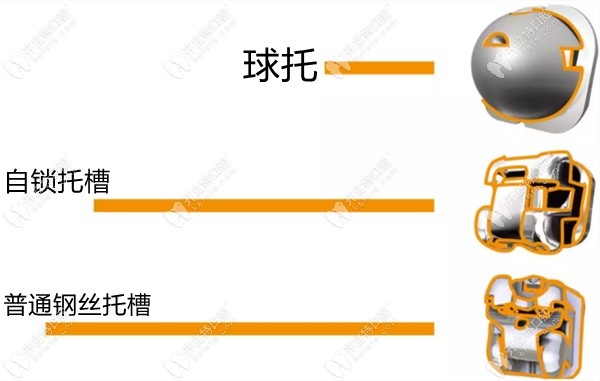 歐歐球型托槽和方型托槽的對比圖