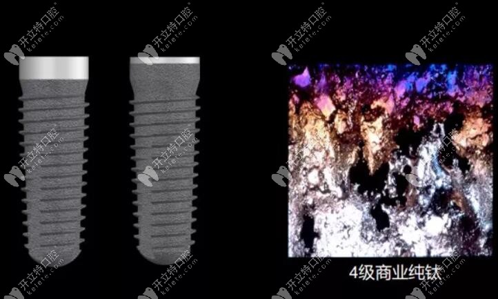 德國(guó)進(jìn)口種植體品牌camlog好不好？看其材質(zhì)性價(jià)比蠻高的