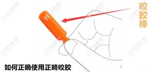 你真的會用隱形正畸咬膠嗎？不正確使用會形成牙套臉哦