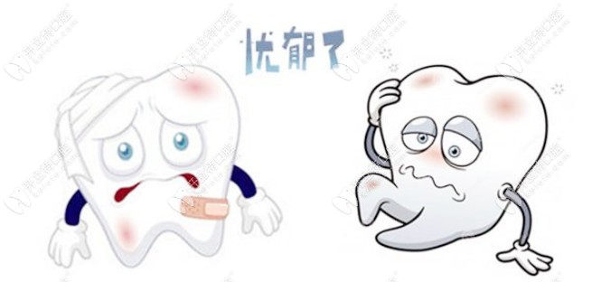 蛀洞太大補(bǔ)牙材料總掉該怎么辦？是時(shí)候了解長(zhǎng)效補(bǔ)牙了