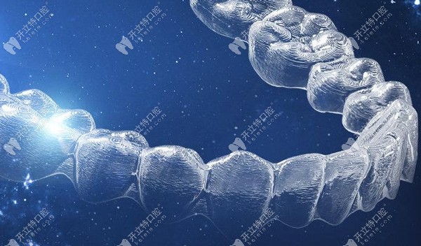 vvsmile隱形矯正器價格