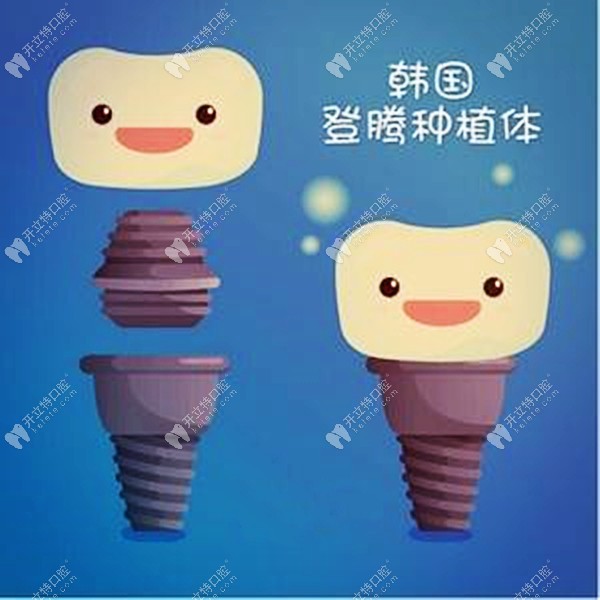 昆明做韓國純鈦登騰種植牙補(bǔ)貼價(jià)2399元一顆，也太便宜了吧