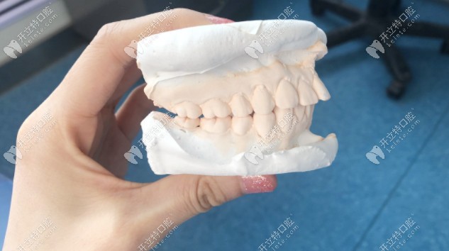 我從天包地到美牙,戴美國奧美科自鎖矯正的這一年經(jīng)歷了啥