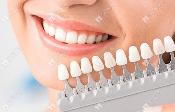 明星同款的皓得適牙齒美白+超聲波潔牙價(jià)格僅需880元起