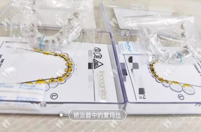 3m黃金incognito舌側(cè)隱形矯正價格一般是多少？講講它的優(yōu)缺點