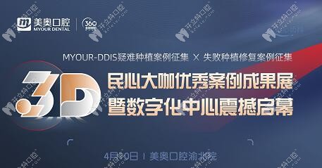 聽說美奧口腔做精準種植牙還不受罪,這場案例直播不能錯過