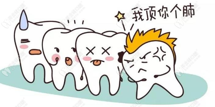 牙齒不齊是一件很痛苦的事 牙齒不齊是一件很痛苦的事