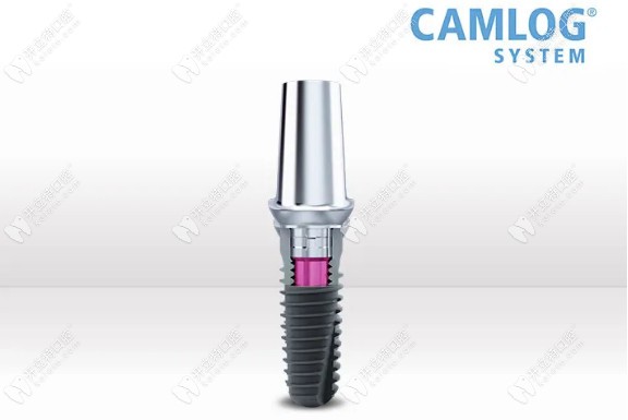 湖<!--<i data=20240703-sp></i>-->眾口腔德國Camlog種植體