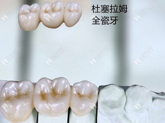 德國(guó)杜塞拉姆樂(lè)瓷氧化鋯全瓷牙好還是威蘭德好,你猜對(duì)了嗎