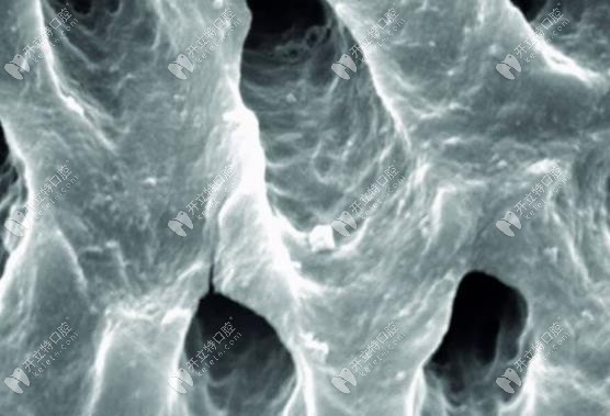 經(jīng)過(guò)EDTA沖洗過(guò)后的根管外觀