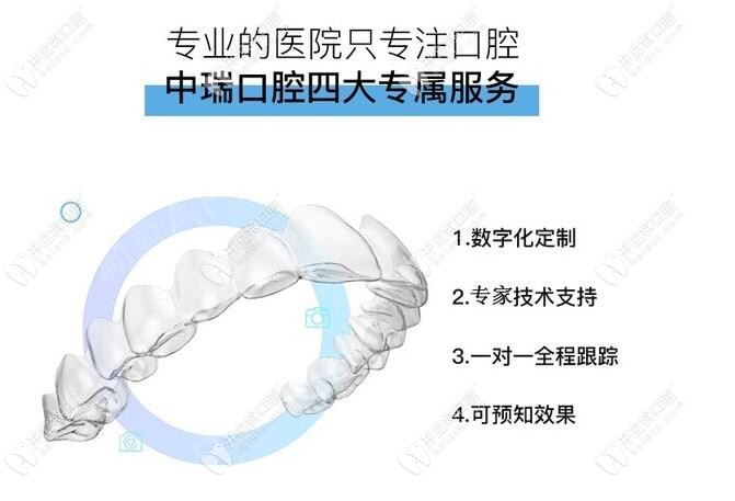 隱形矯正器的優(yōu)勢 隱形矯正器的優(yōu)勢