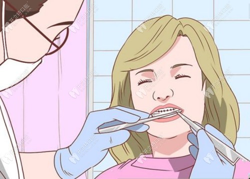 楊醫(yī)生粘托槽的時候十分認真 楊醫(yī)生粘托槽的時候十分認真