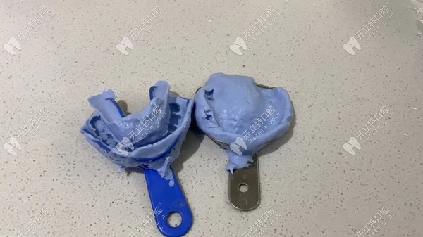 制作的牙模圖示 制作的牙模圖示