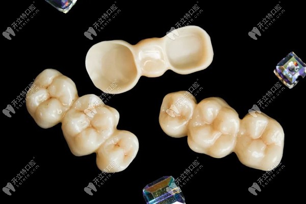 秀美瓷?氧化鋯全鋯冠怎么樣