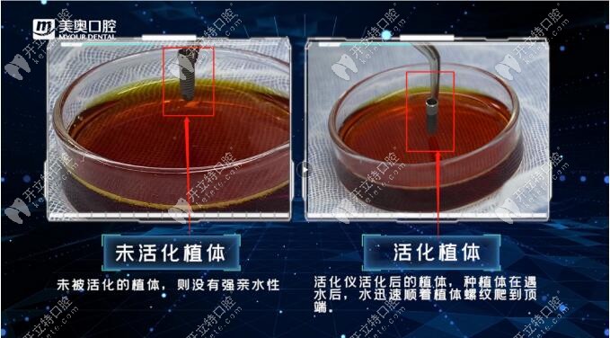 植立刻高疑難種植術15分鐘可將普通植體變成親水植體,那.....