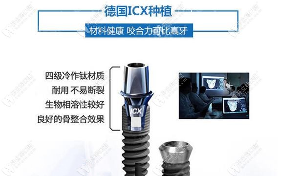 德國icx種植牙的材料介紹與特征