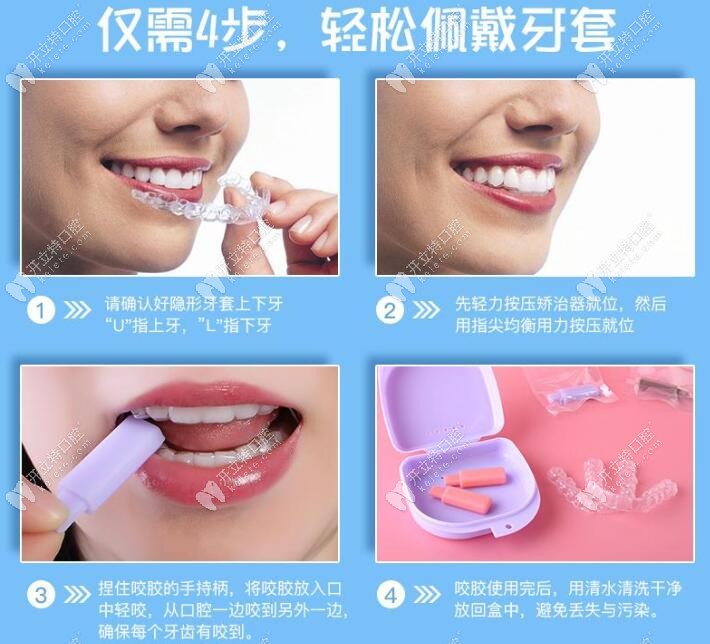 牙齒正畸咬膠使用方法