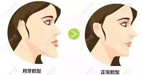 矯正失敗還是成功對比明顯