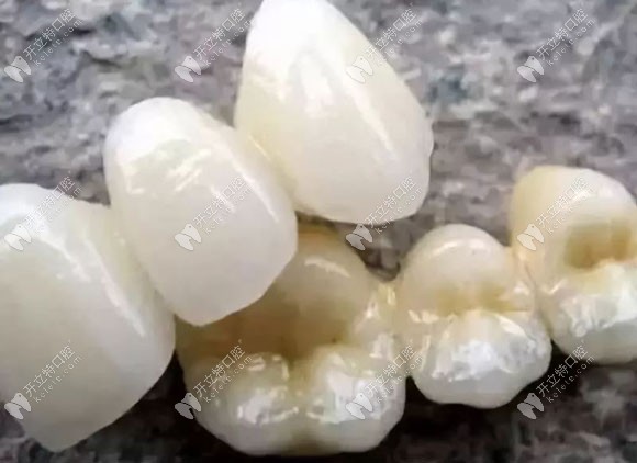 進(jìn)口全瓷牙冠系列