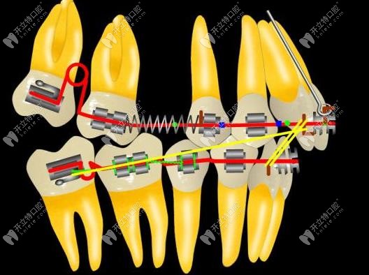 定向力矯正技術(shù)過程示意圖