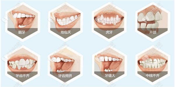 精誠口腔院內(nèi)可矯正的病例