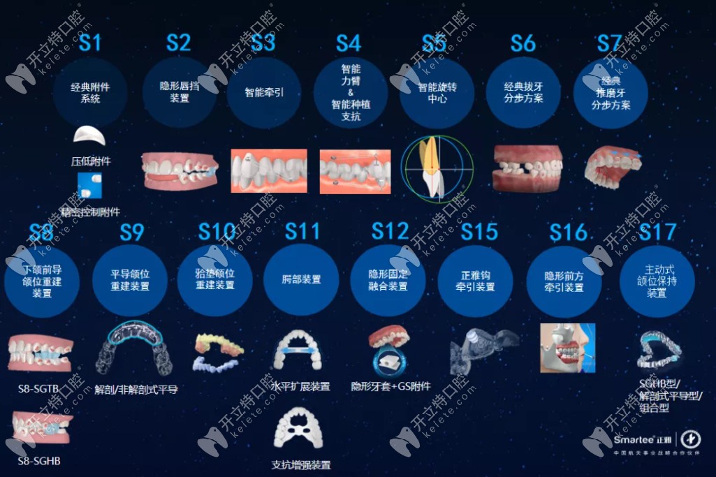 恭?！墩胖鲃有皖M位保持器S17》新款亮相