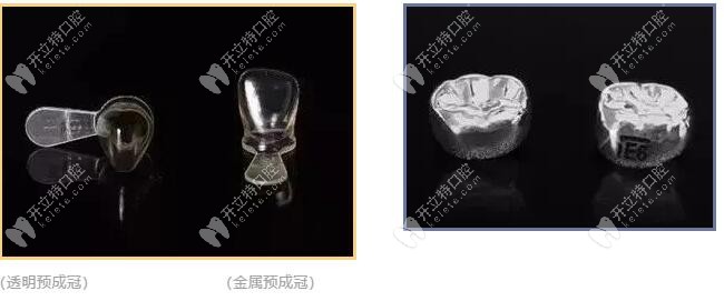 乳牙預(yù)成冠是什么