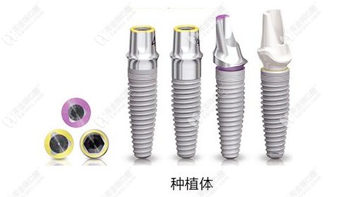 分享沈陽盛大口腔價(jià)格表，盛大做種植牙口碑好價(jià)格還不貴