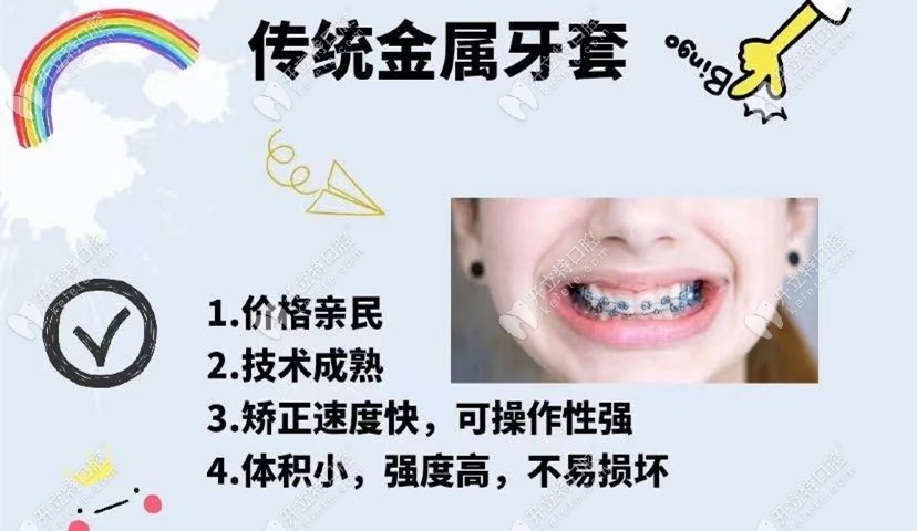 鋼牙套優(yōu)點(diǎn)