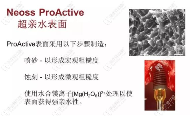尼奧斯種植系統(tǒng)是什么材質