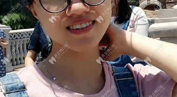 二次做矯正的小姑娘