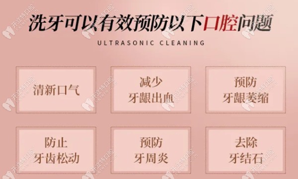洗牙的優(yōu)點
