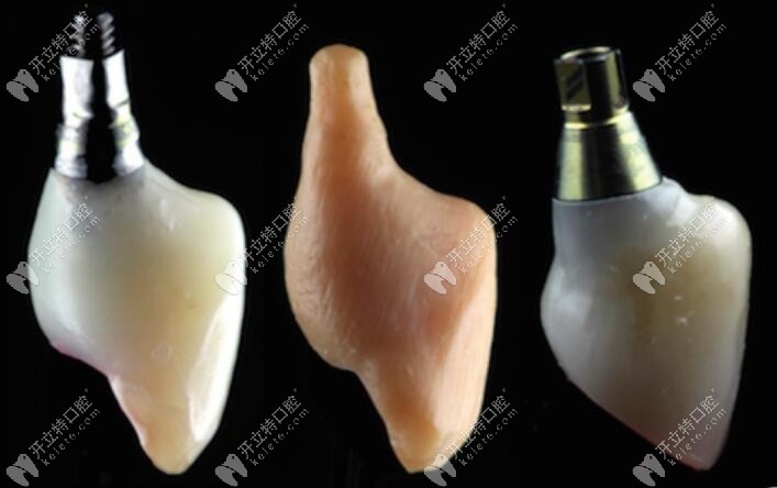 牙冠制作的形態(tài)變化