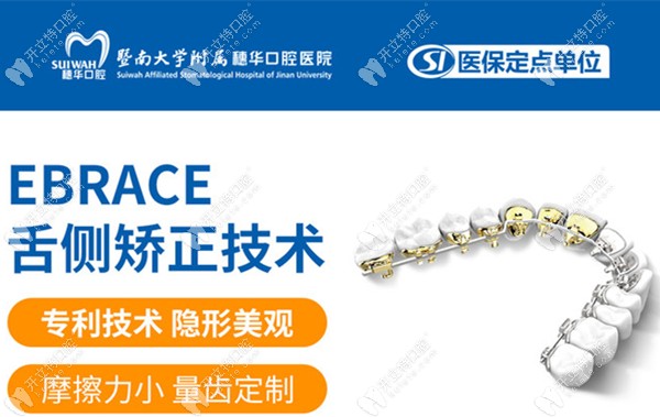 eBrace舌側隱形正畸的優(yōu)勢