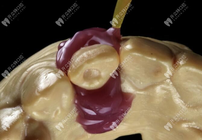 涂分離劑并進(jìn)行模型復(fù)制