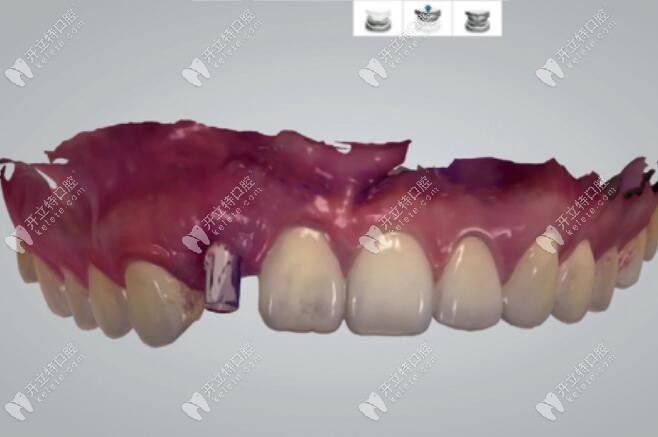 放入掃描桿并進(jìn)行掃描