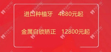 曙光口腔發(fā)來韓國登騰種植牙4880元起優(yōu)惠價格，終于等到了