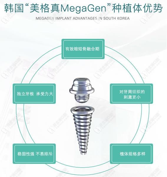 韓國美格真種植體的優(yōu)勢