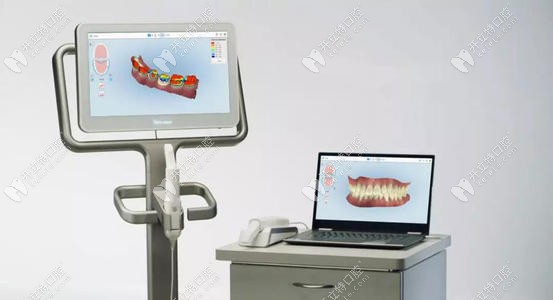 口掃設(shè)備實拍圖 口掃設(shè)備實拍圖